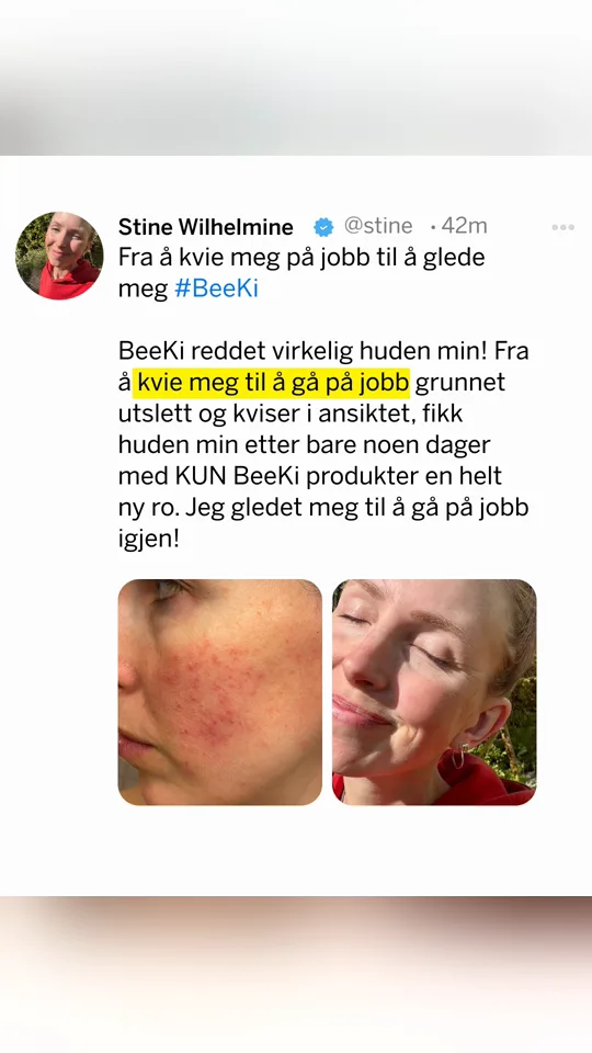 Beeki: kundeomtale om hudrutine