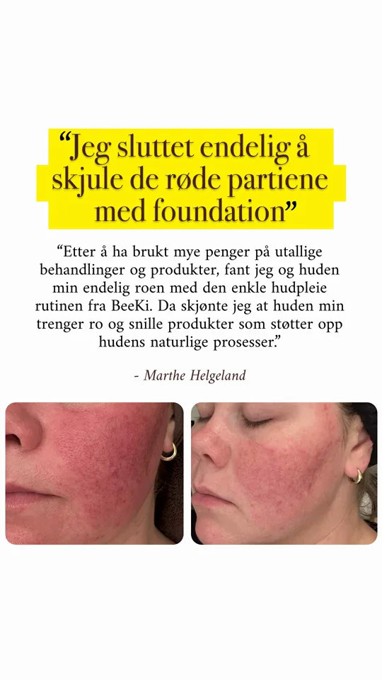 Beeki: sluttet å skjule de røde partiene
